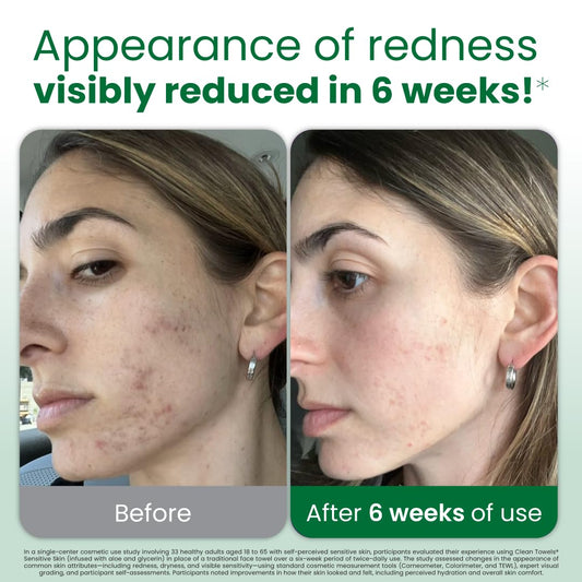xl size for full-face and hand coverage in one wipe