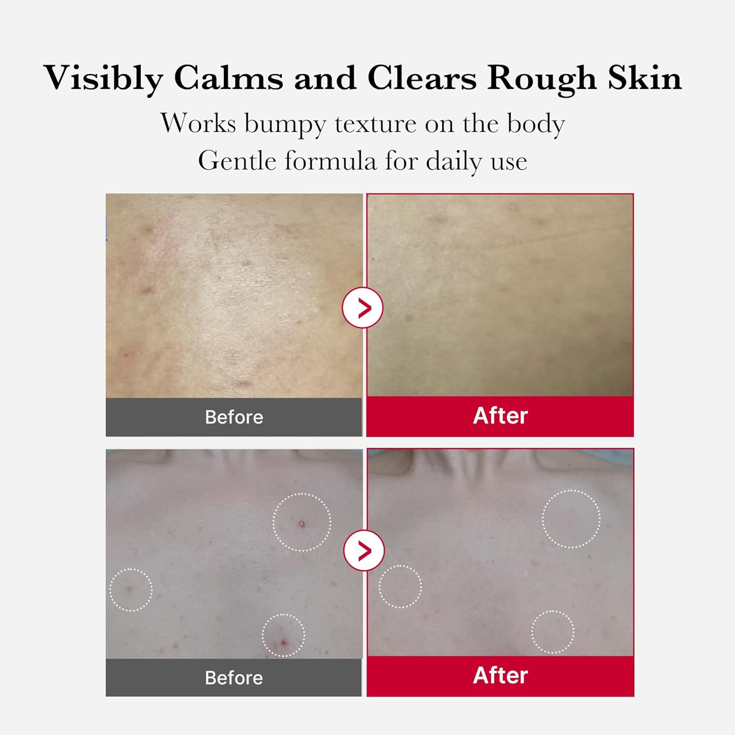 1-minute rinse-off chemical exfoliant (no scrubbing required)