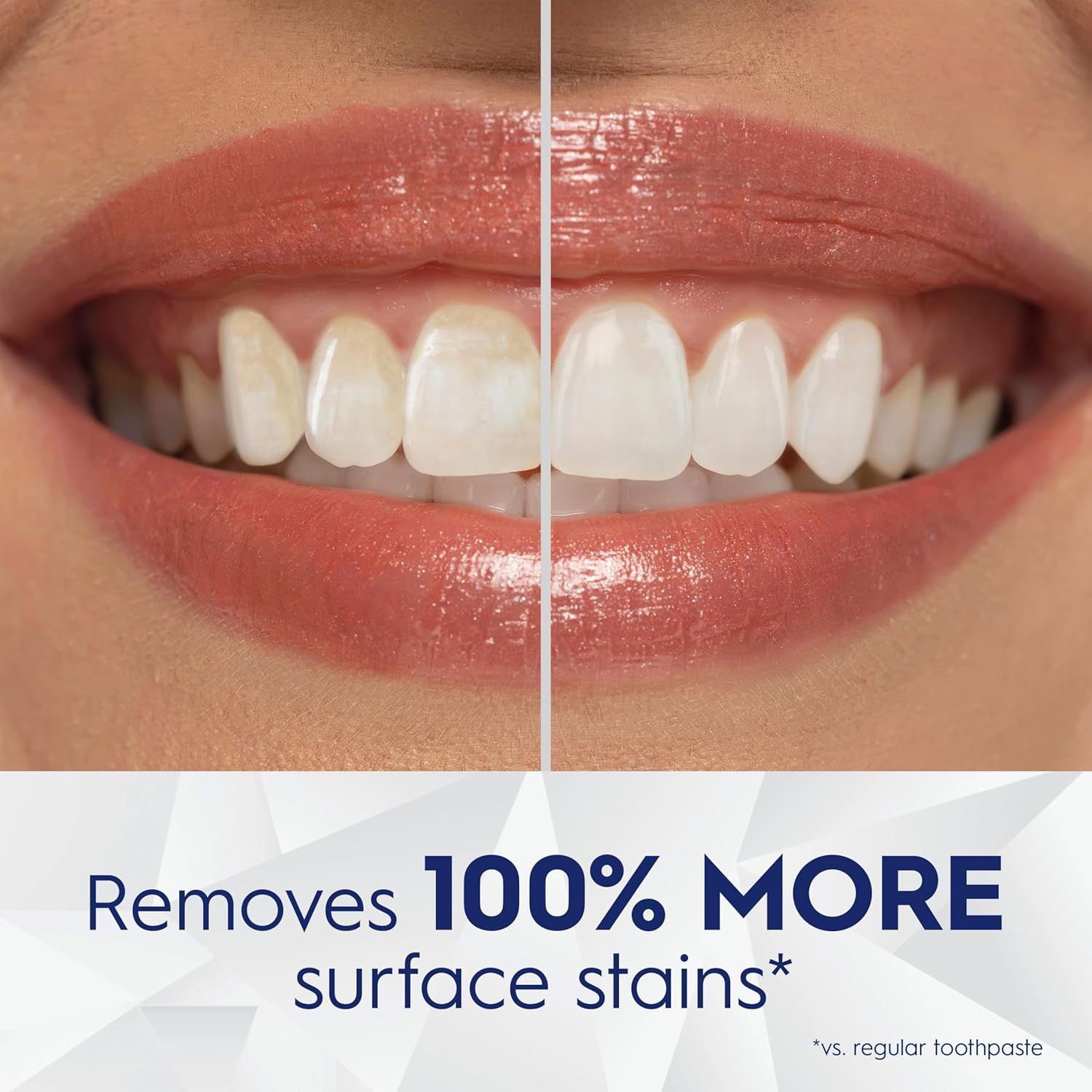 24-hour active stain prevention technology with twice-daily use