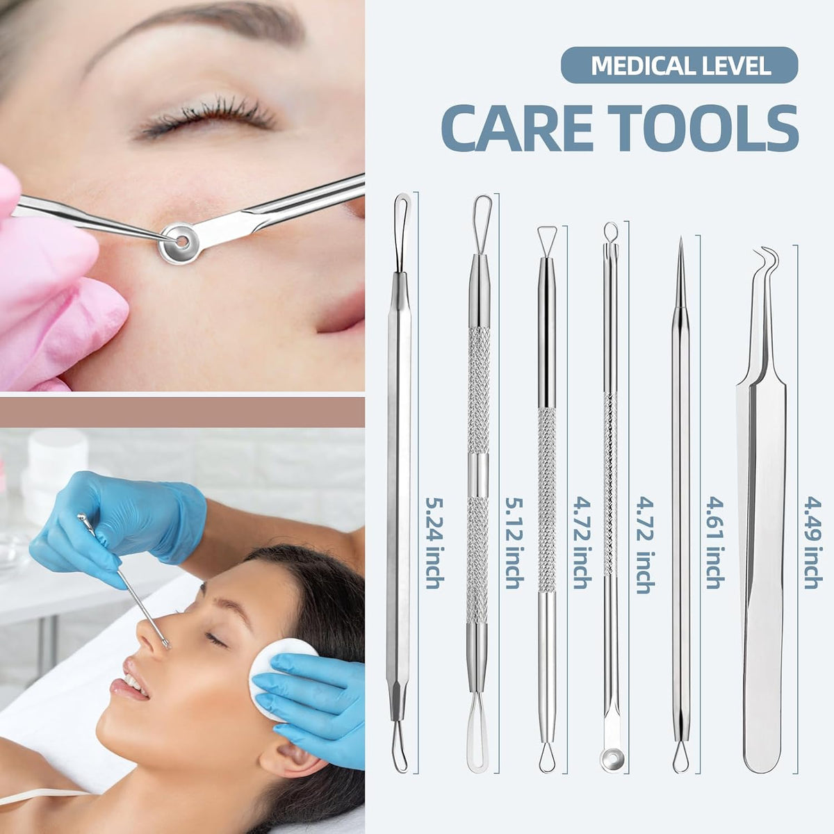 Acne Removal Kit – Dermatologist-Inspired Extractor Tools for Safer DIY Extractions