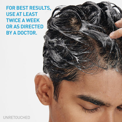 CeraVe Pure Scalp Care – Free of Sulfates, Dyes & Parabens, Clinically Tested Anti-Dandruff Treatment