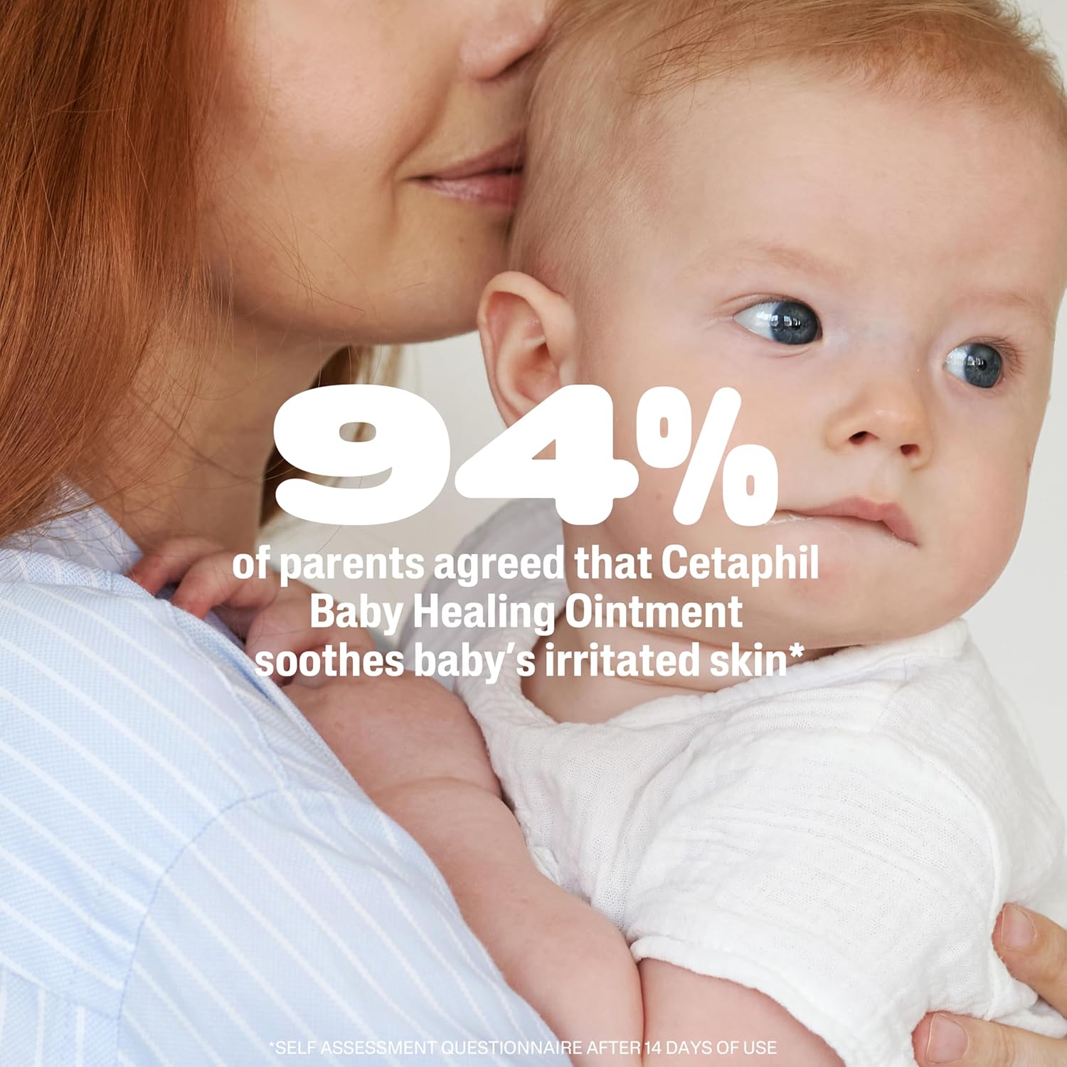 Cetaphil Baby Diaper Rash Ointment – Pediatrician-Trusted Skin Protectant for the Changing Table, 12oz