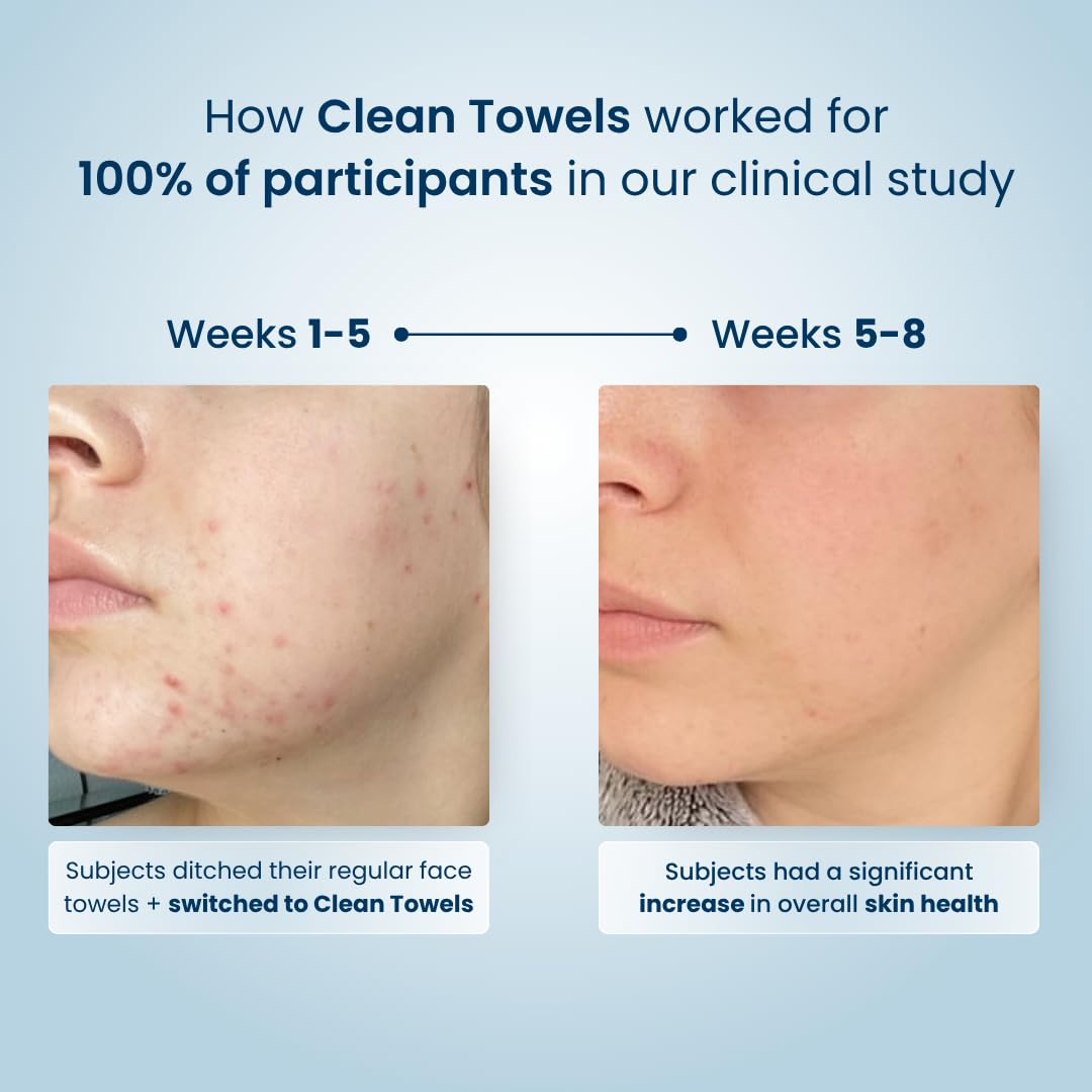 Clean Skin Club Clean Towels® – Bacteria-Free Drying Towels for Hygiene-Conscious Bathrooms, 25 Ct