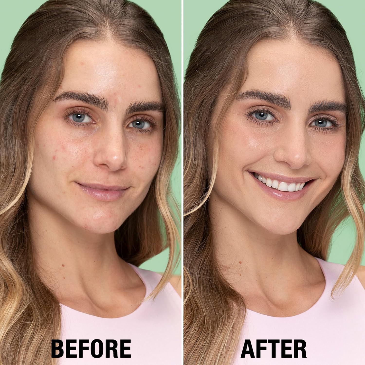 compatible with full-face or targeted-zone (t-zone, chin) application