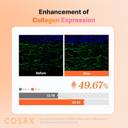 COSRX 5 PDRN Collagen Intense Vitalizing Serum – Thoughtful Mother's Day Gift for Women Who Love K-Beauty, Glowing Skin Serum
