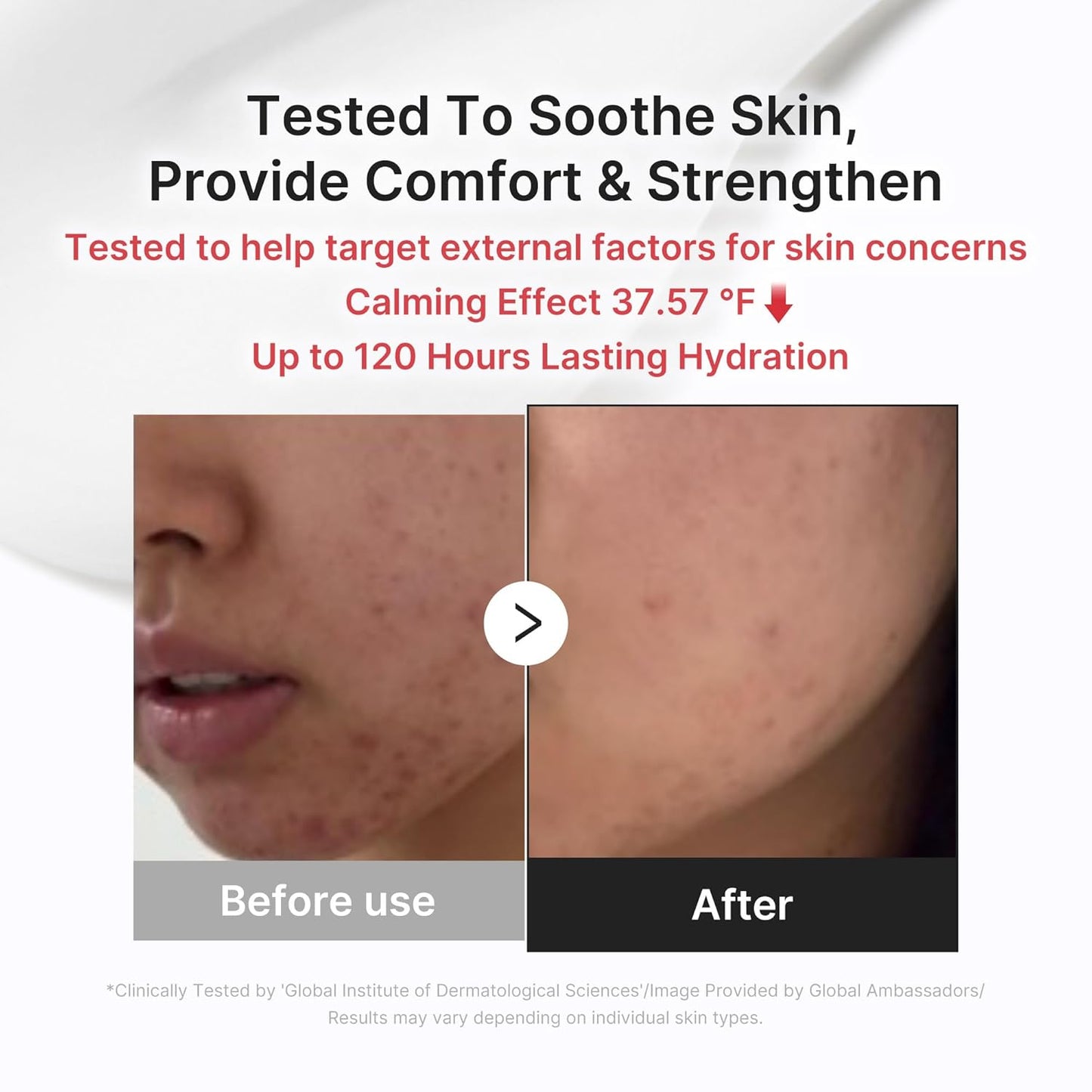 dermatologically tested, non-comedogenic, and low-irritation validated