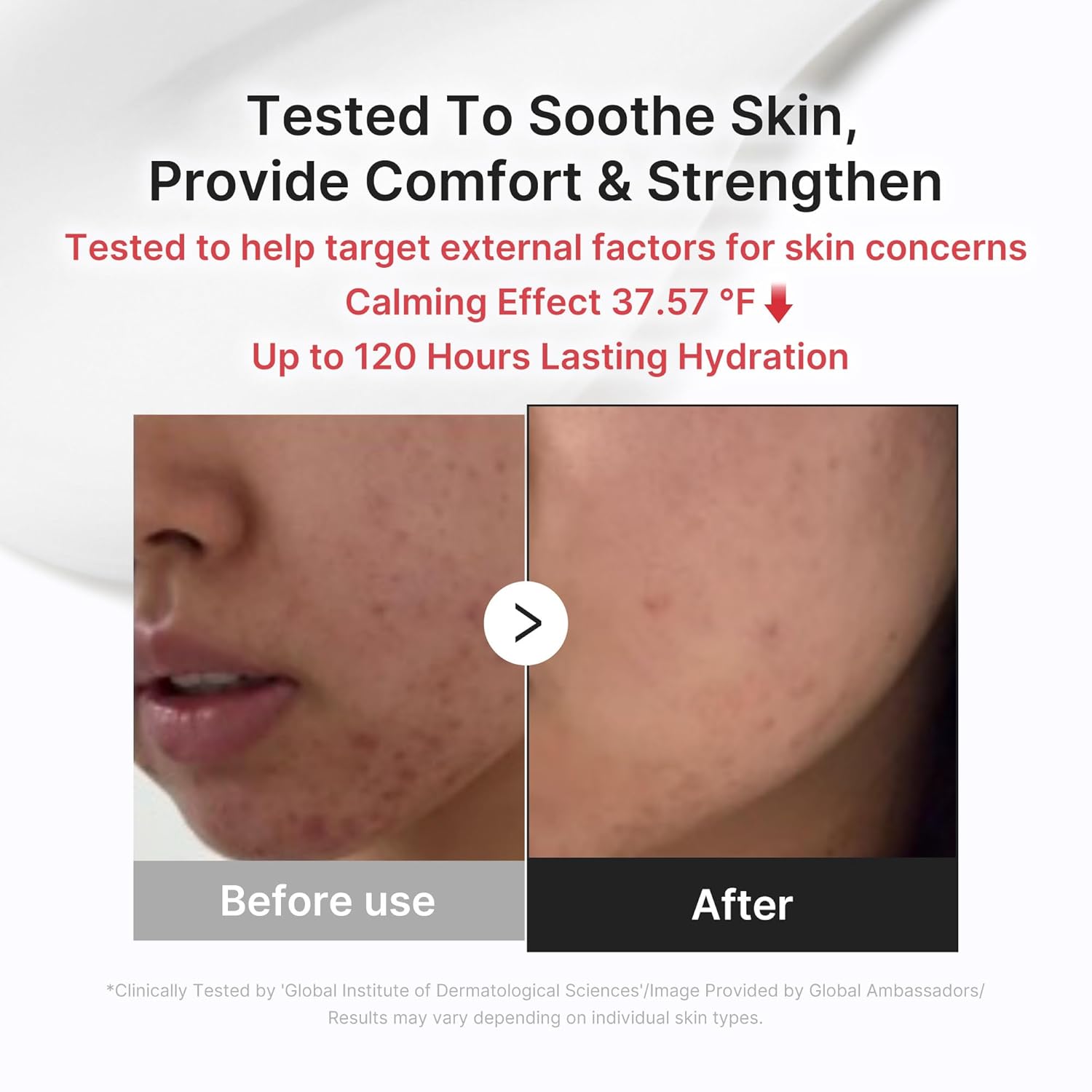 dermatologically tested, non-comedogenic, and low-irritation validated