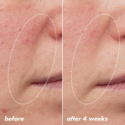 dropper bottle delivering 3-5 drops per application for face and neck