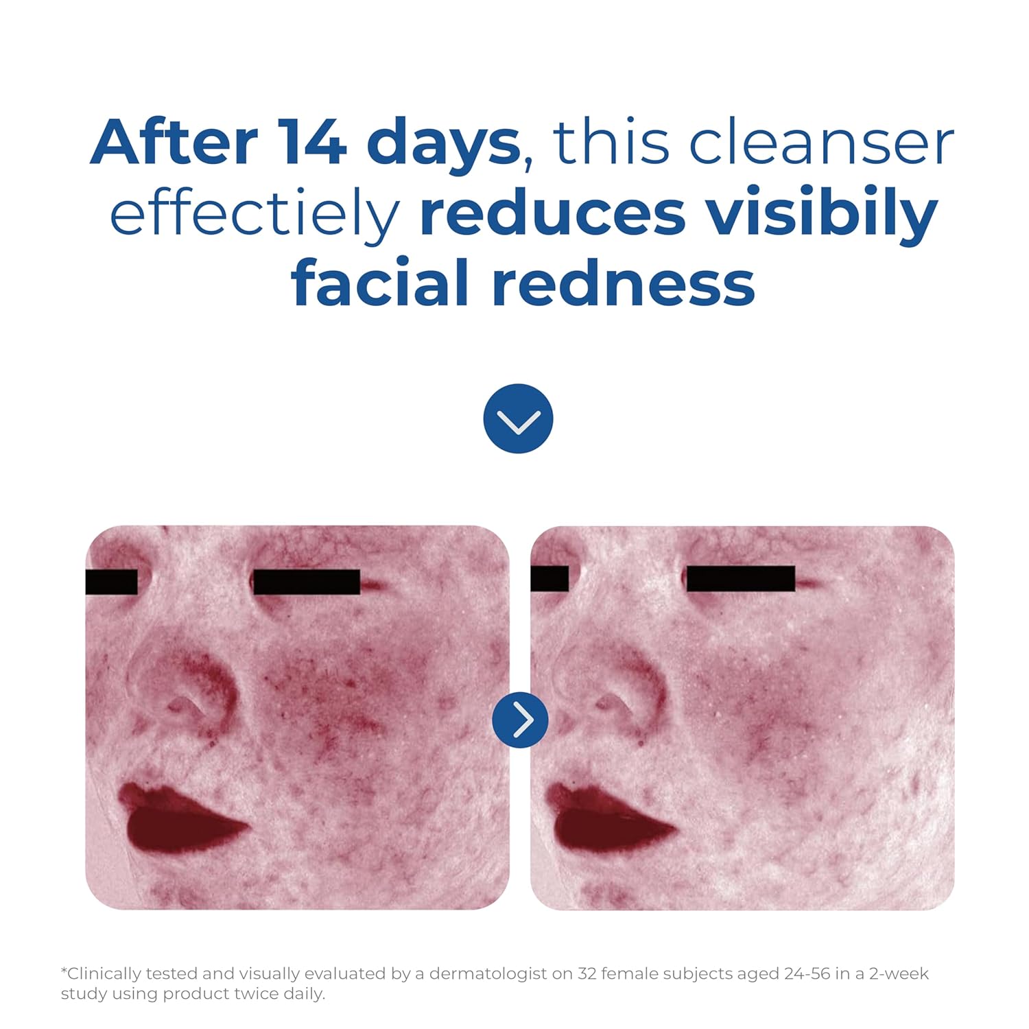 EltaMD Skin Recovery Cleanser – Essential One-Step Morning & Evening Facial Wash