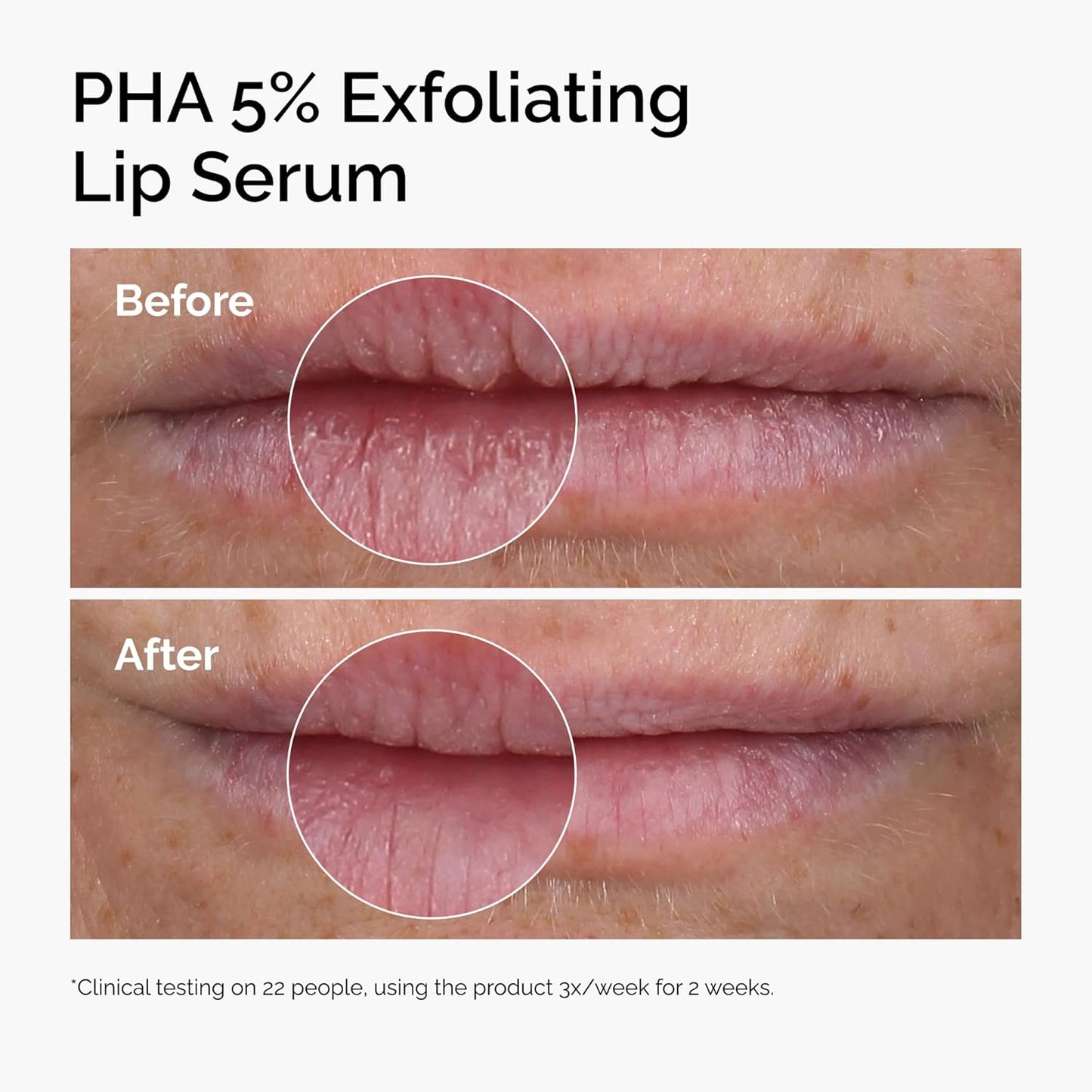 glycerin and ectoin for hydration retention and barrier support