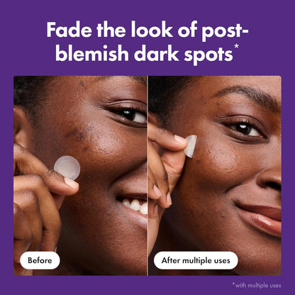 Hero Cosmetics Mighty Patch Micropoint Hyperpigmentation Patches – Intentional Single-Step Spot Treatment, Neutral Vanity Edit