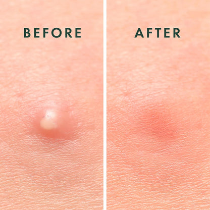 hypoallergenic, non-drying formulation safe for all skin types