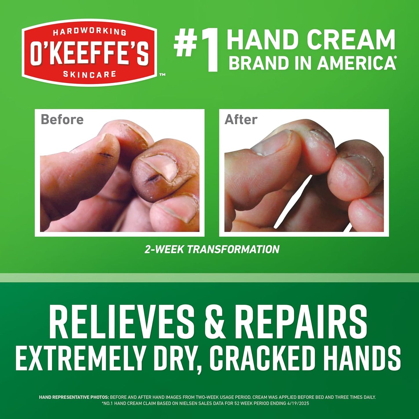hypoallergenic, unscented, and non-greasy formula
