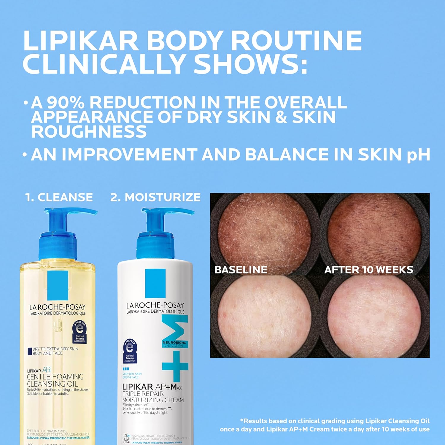 La Roche-Posay Lipikar AP+MAX Hypoallergenic Moisturizer | National Eczema Association-Accepted Barrier Repair