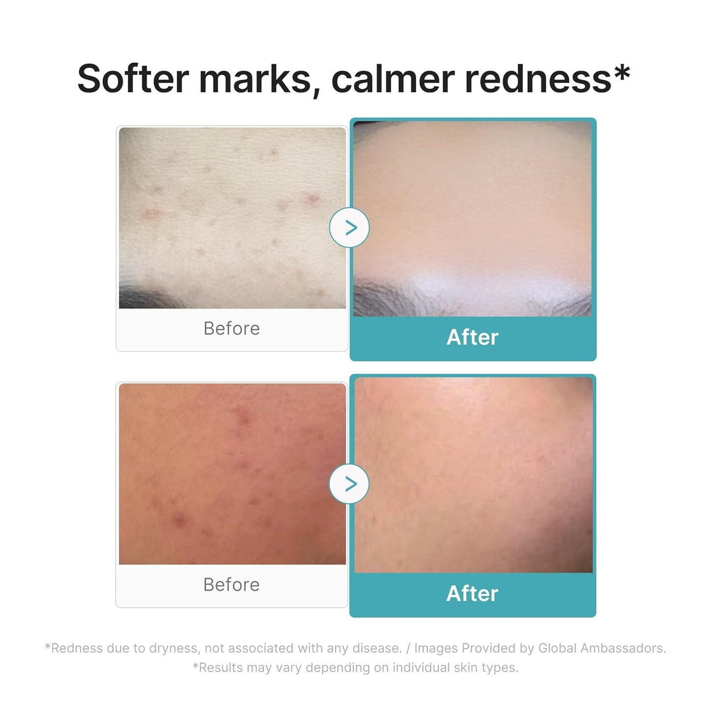 lightweight, non-sticky serum texture with dropper applicator