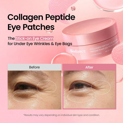 multi-zone design suitable for under-eyes, smile lines, forehead, and neck