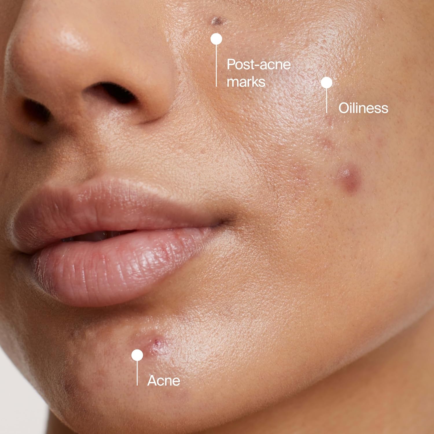 Neutrogena Evenly Clear 2-in-1 Acne Mask & Cleanser – Self-Care Nightly Wind-Down for Confident, Healthy-Looking Skin