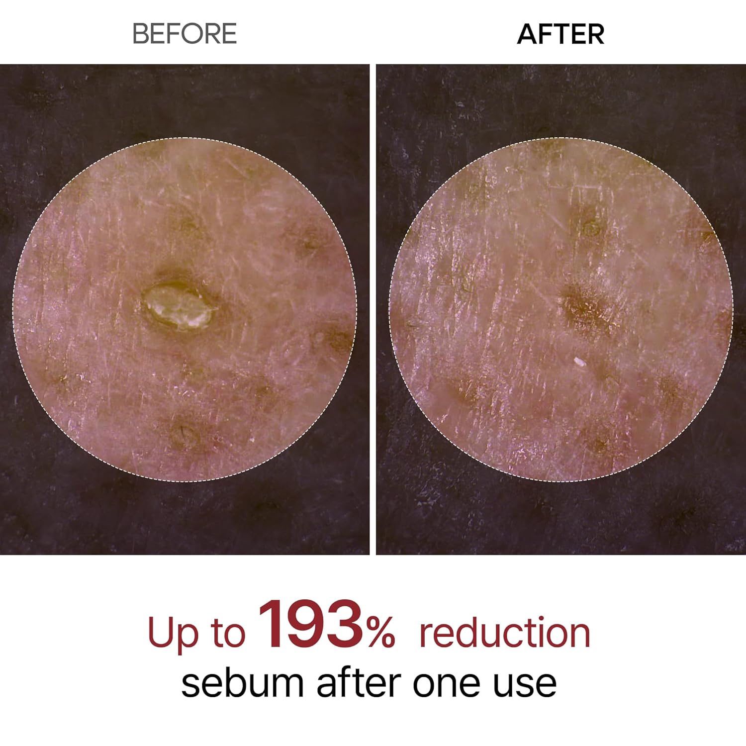 niacinamide for brightening and pore refinement