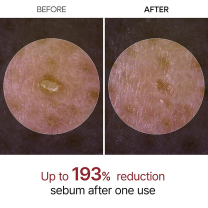 niacinamide for brightening and pore refinement