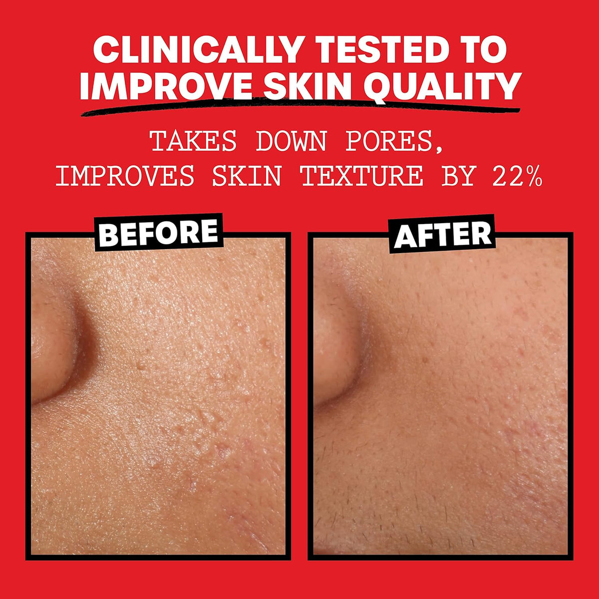 ph-balancing formula that constricts pores and controls oil production