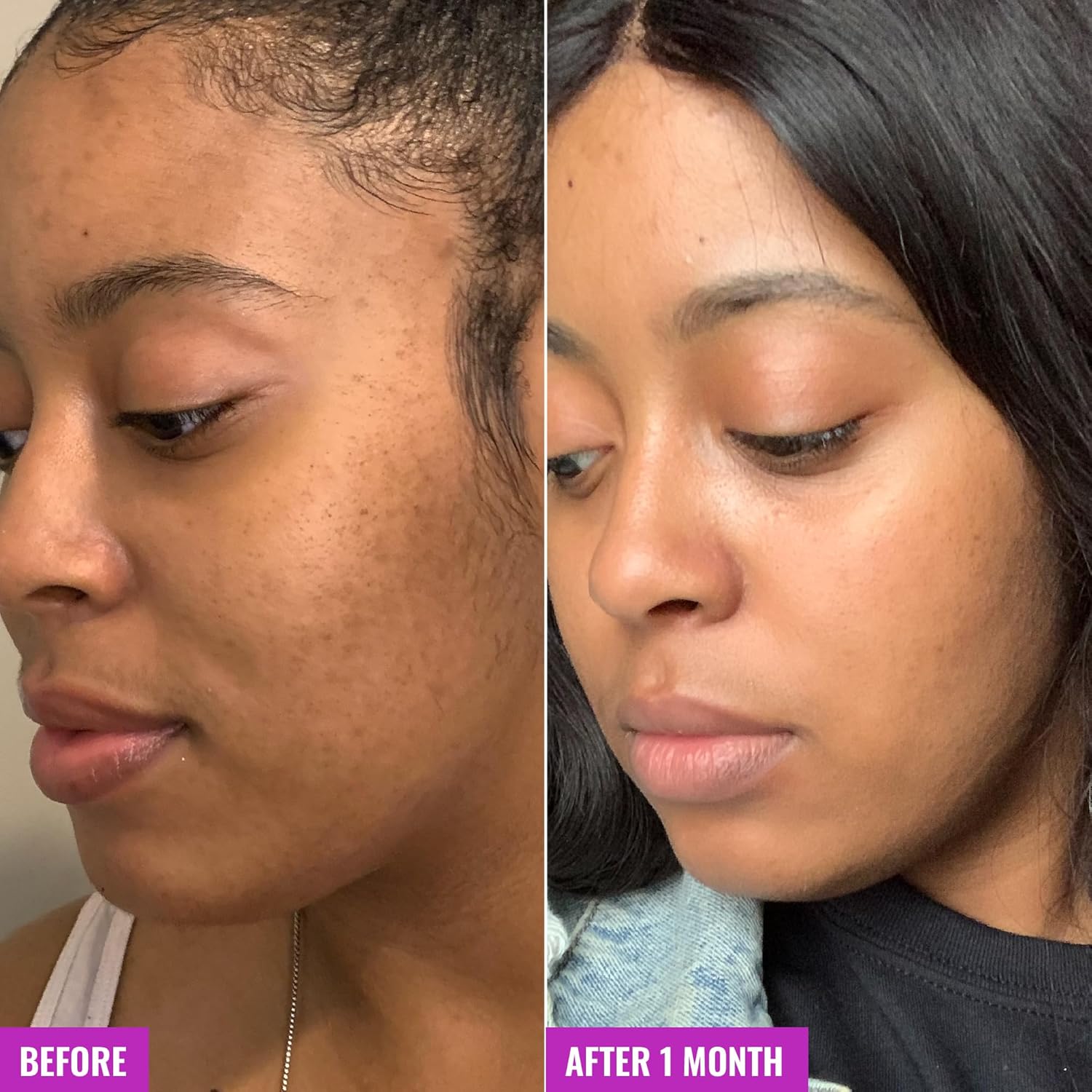 ph of 4.2 optimized for both efficacy and skin comfort
