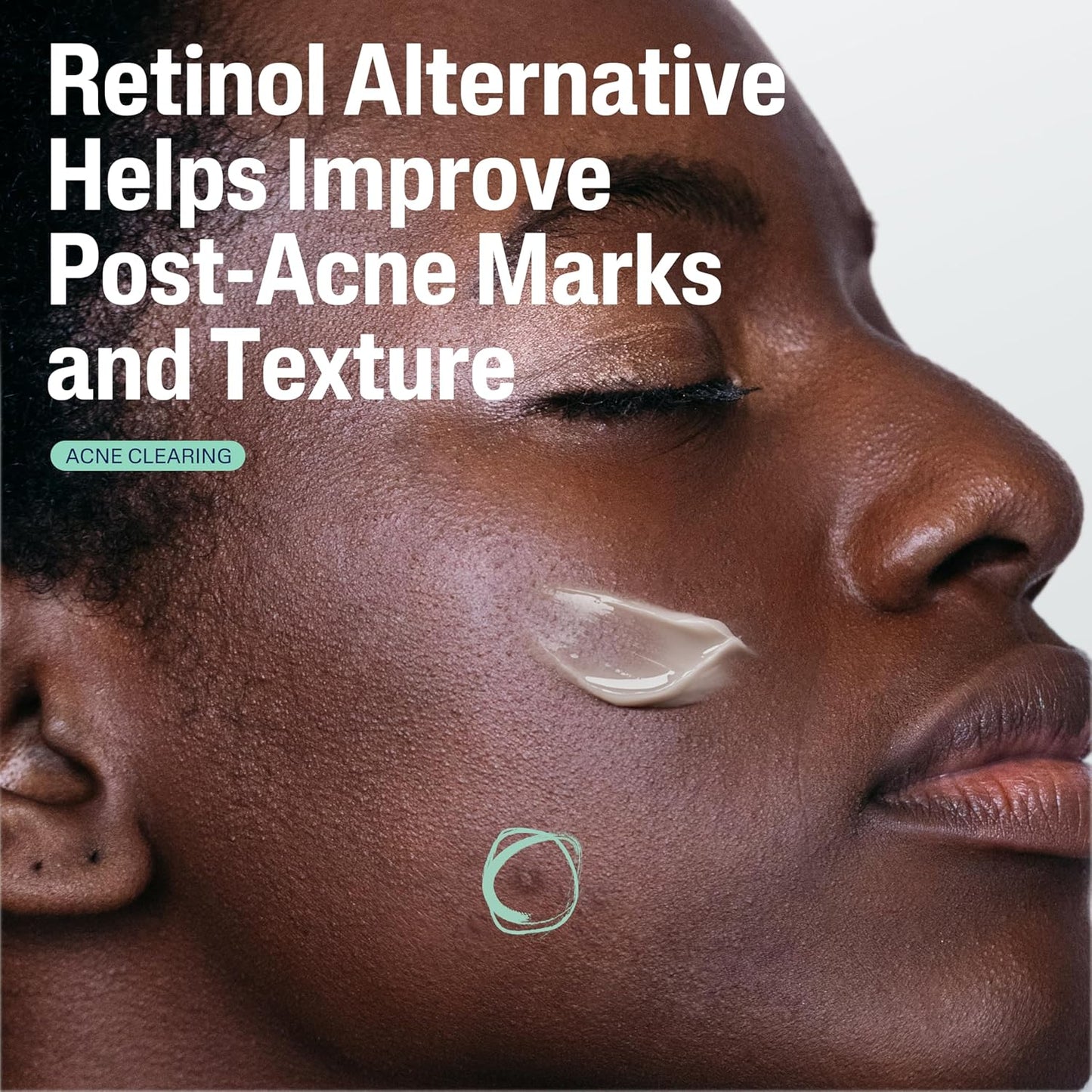 prebiotics to strengthen the skin's protective moisture barrier