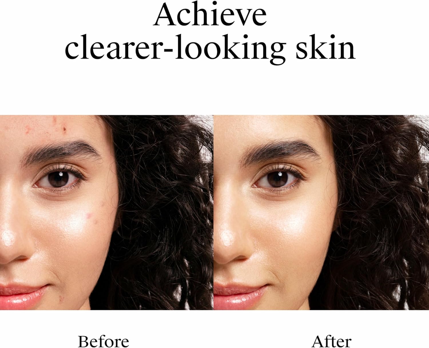 targeted spot treatment applicator for precise, mess-free use