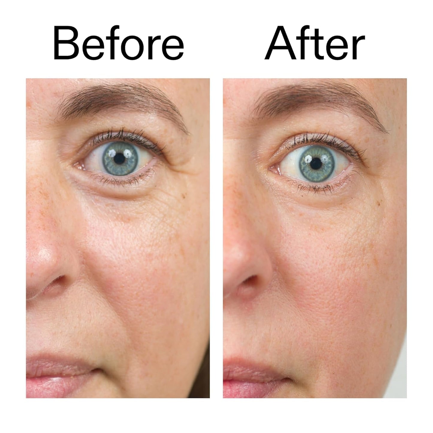 The INKEY List Bio-Active Ceramide Plumping Moisturizer for Evening Wind-Down Self-Care, Fragrance-Free Anti-Aging Cream