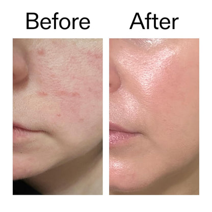 The INKEY List Exosome Hydro-Glow Complex – Mindful Self-Care Treatment for Bathroom Vanity Wind-Down, Daily Radiance Boost