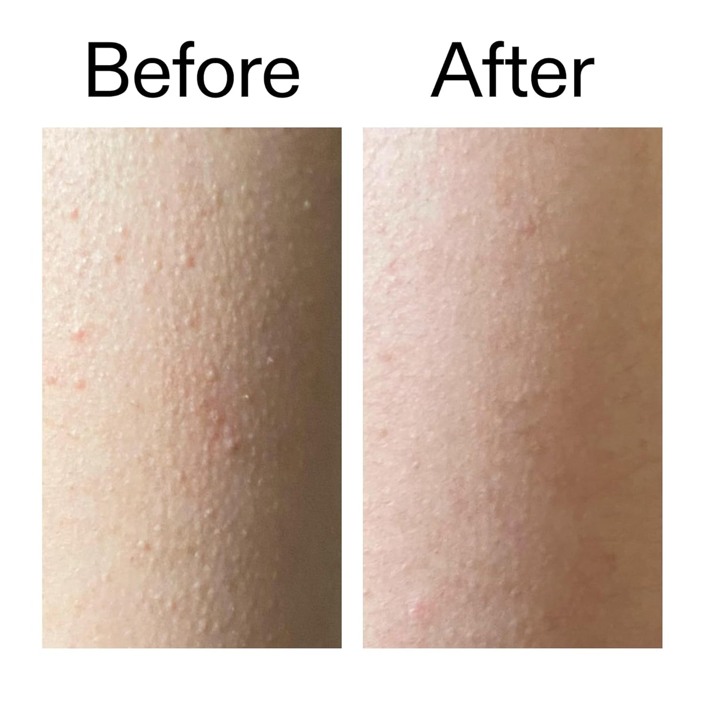 The INKEY List Glycolic Acid Exfoliating Body Stick – Travel-Size Pick for Beach, Gym, and Camping
