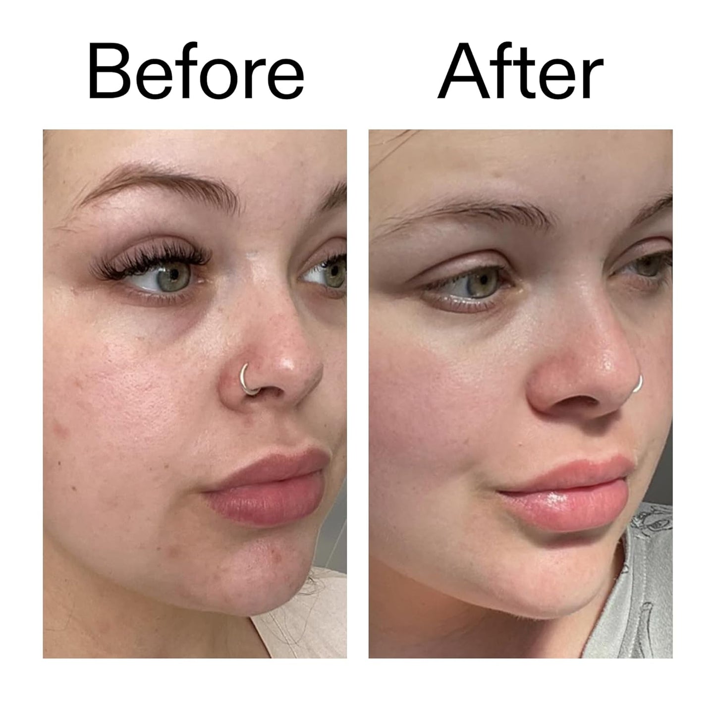 The INKEY List Omega Water Cream, Fragrance-Free Barrier Cream for Sensitive, Reactive Skin Prone to Irritation