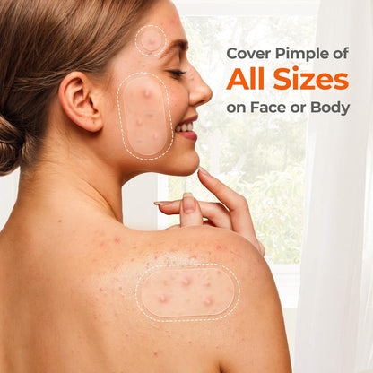 TKTK XL Hydrocolloid Patches – Wellness-Friendly Body and Face Spot Care for Mindful Bath Time