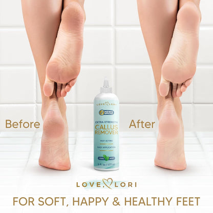 two product variants: standalone gel (b07hrycwqz) and full callus remover kit (b09ttpbqd8)