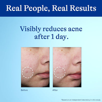 unscented, targeted spot treatment applicator