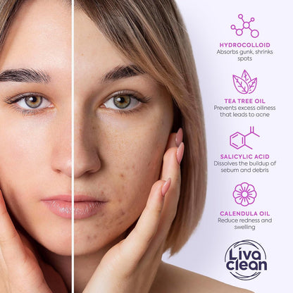variant 1: original triple-ingredient formula; variant 2: bundle with pink superstar decorative patches; variant 3: 100% pure hydrocolloid with no active ingredients for ultra-sensitive skin