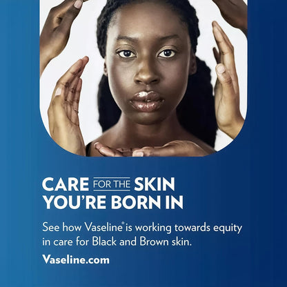 Vaseline Rosy Lips Single Mini Jar – Understated Tinted Lip Balm for a Clean Vanity Setup