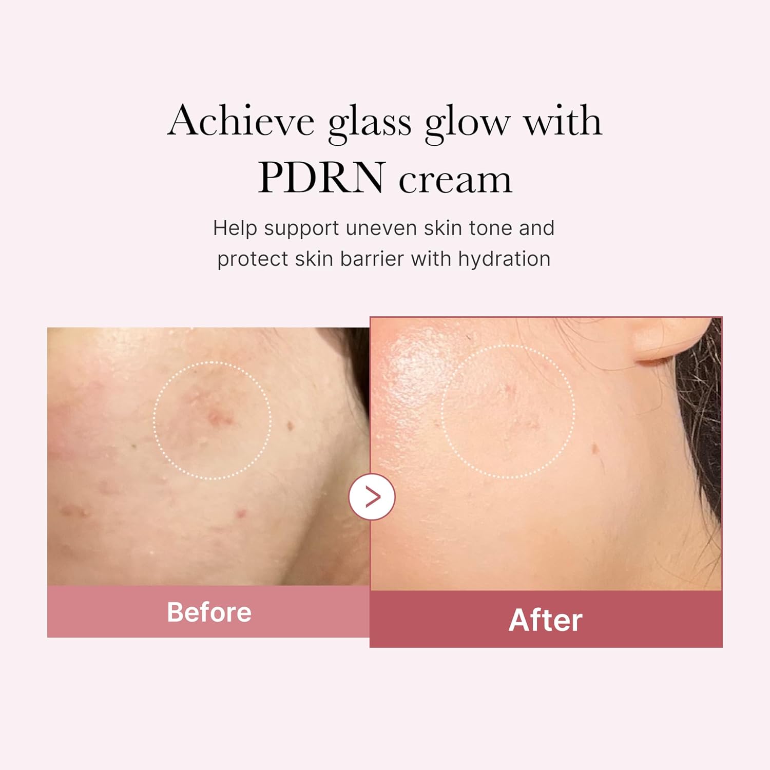vegan-certified cream formulation suitable for all skin types