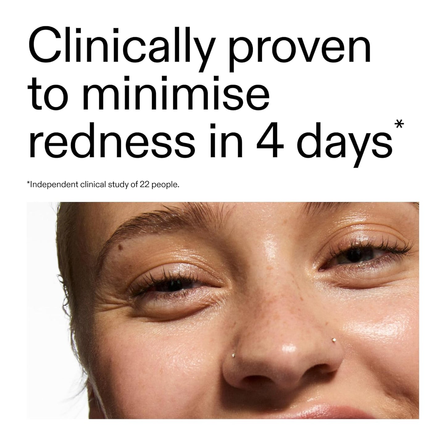 white-cast-free finish