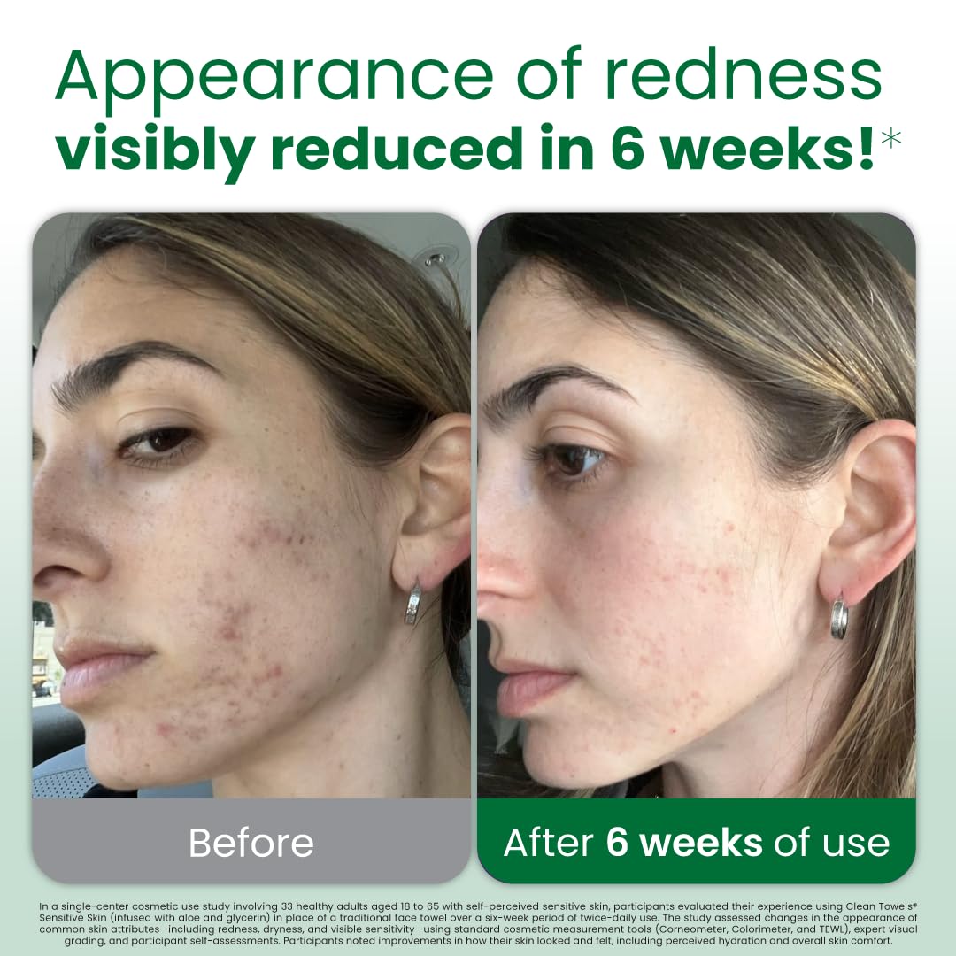 xl size for full-face and hand coverage in one wipe