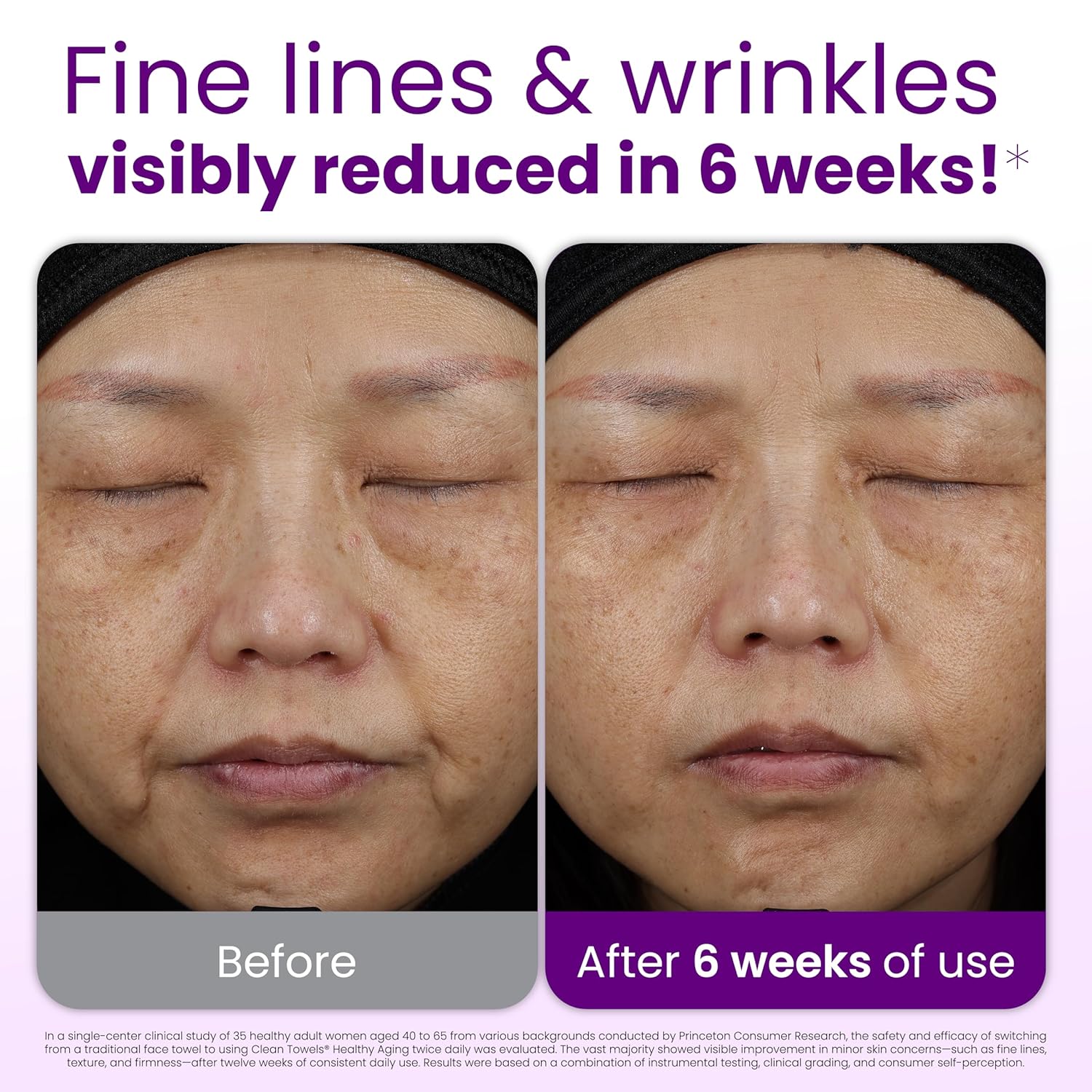 xl-sized format treated for extra softness on facial skin